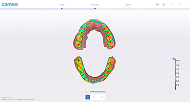 Rapid 3 Intraoral Scanner